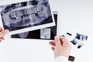 Panoramic dental x-ray image of teeth. Dentist